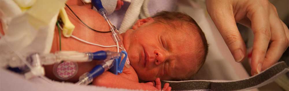 Another ‘Shaken Baby Syndrome’ Story Here in Michigan… Abused infant in hospital bed