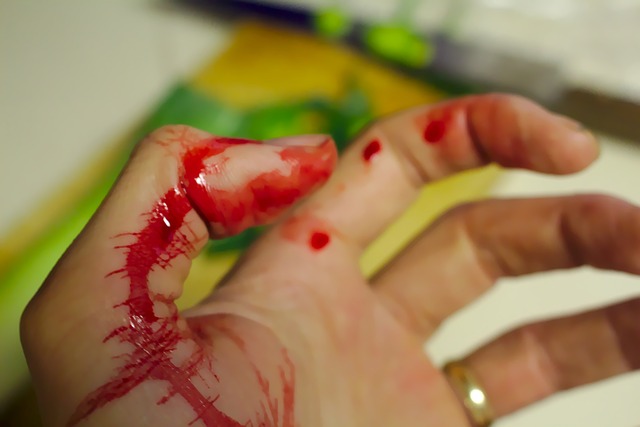 A close up of a woman's hand. Her wedding ring is visible, but she has blood on her fingers.